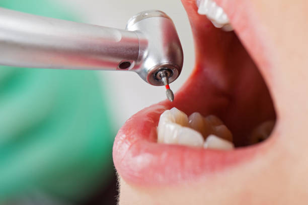 Best Pediatric Emergency Dentist in Black Jack, MO